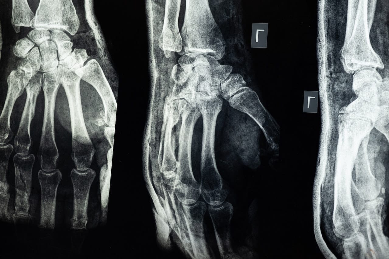 medical imaging of an injury