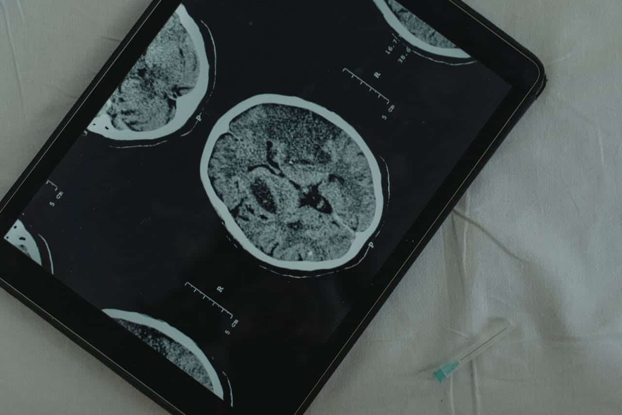brain scan on tablet