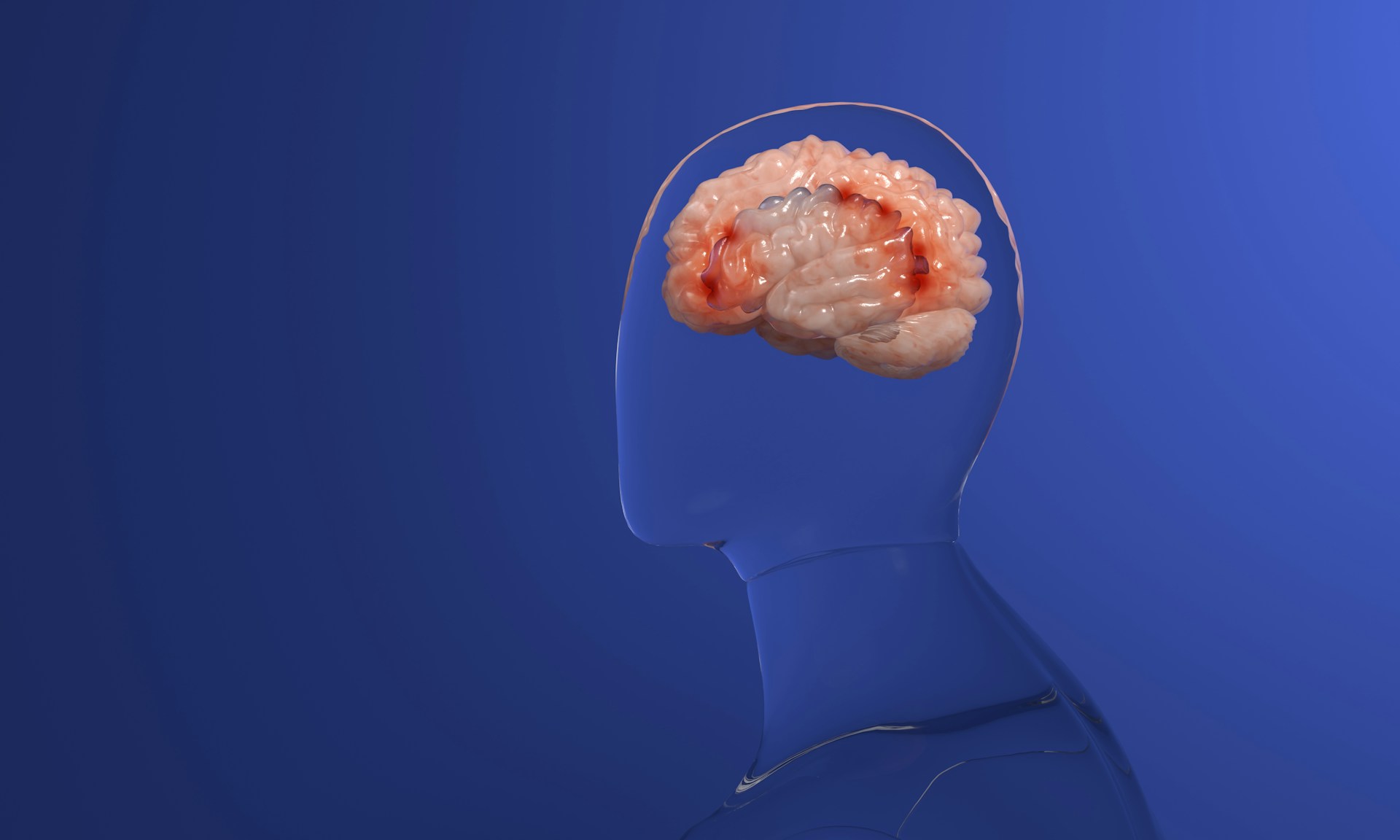 A pink brain inside a clear out;line of a person against a deep blue background, representing Traumatic brain injuries in Alberta.